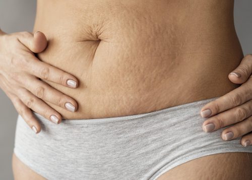 Mezoterapia mikroigłowa (Oxypin lub Derma Fusion Pen Platinum) na wybranym obszarze ciała